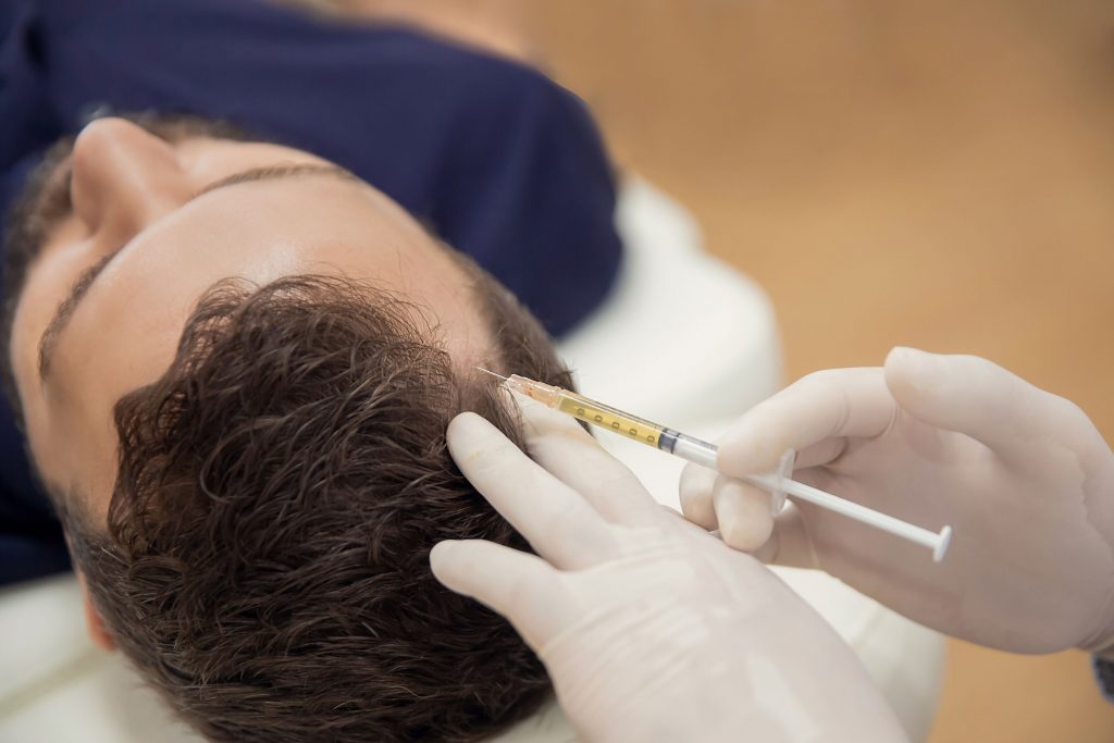 PRP Hair Loss Treatment London
