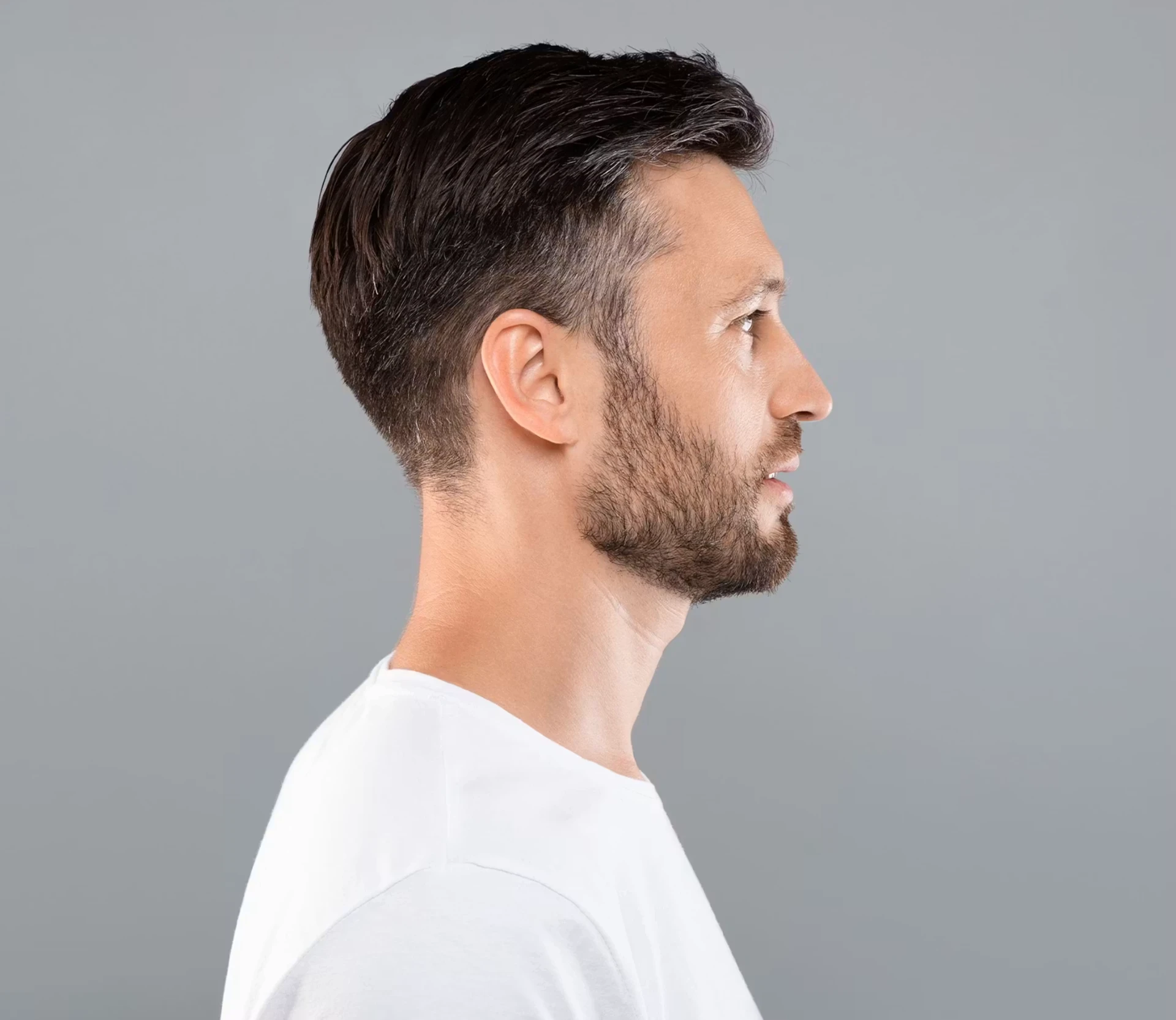 Beard and facial hair transplant at London Hair Transplant Clinic