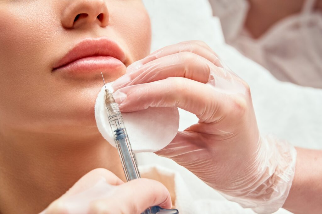 Lip Augmentation at London Hair Transplant Clinic