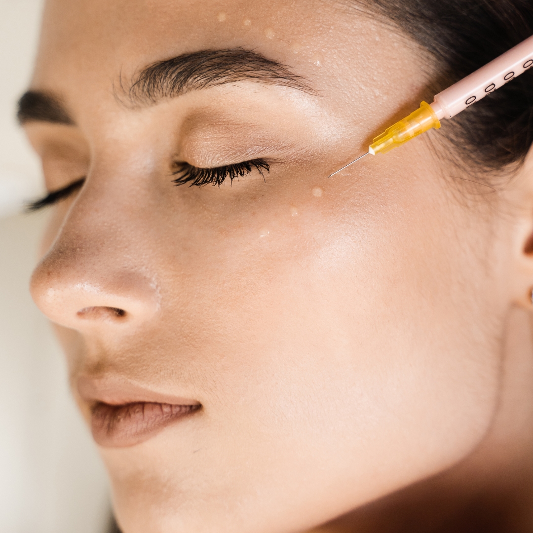 Dermal filler treatment at London Hair Transplant Clinic