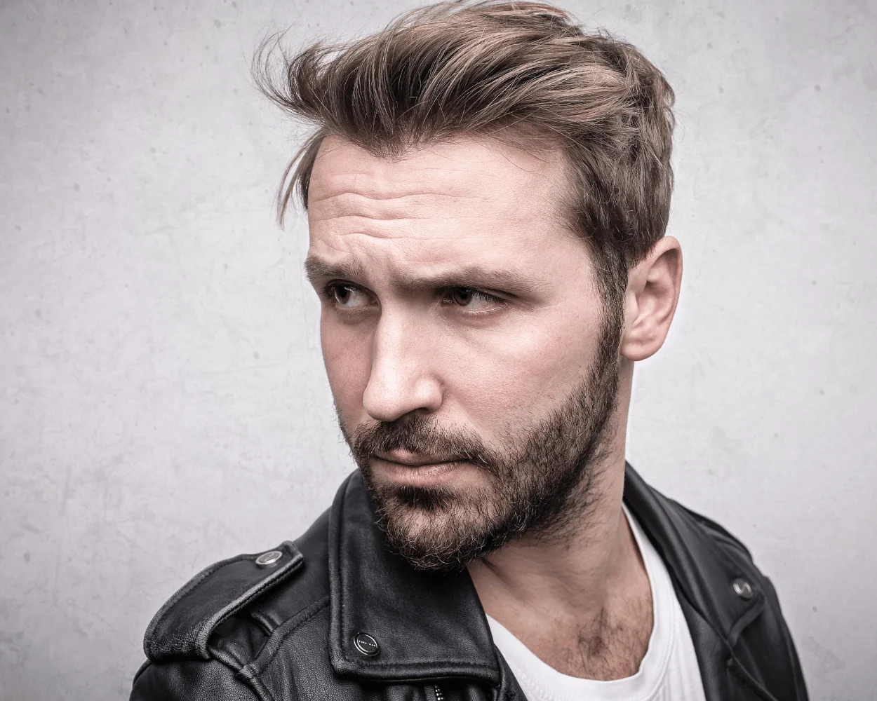 Beard and facial hair transplant at London Hair Transplant Clinic