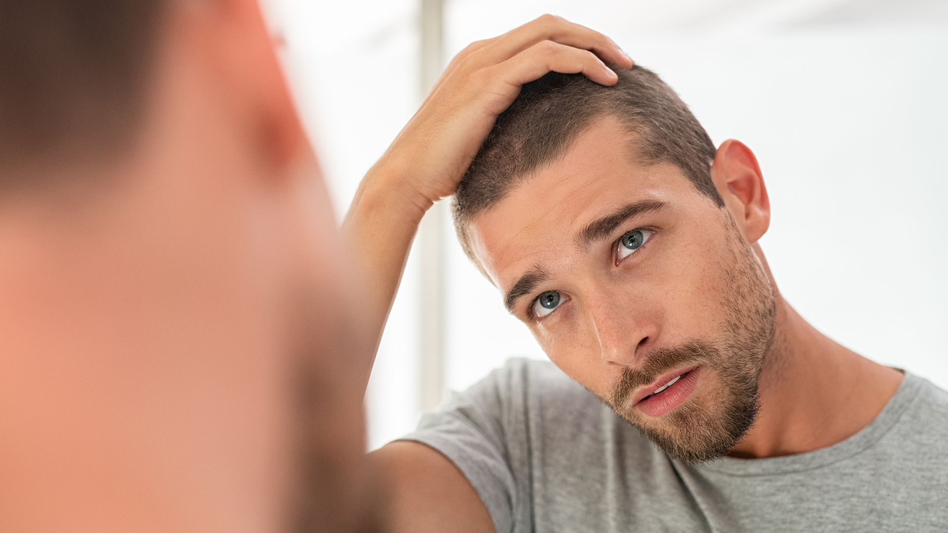 FUE hair transplant at London Hair Transplant Clinic