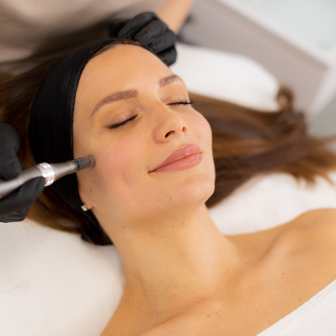 Dermal filler treatment at London Hair Transplant Clinic