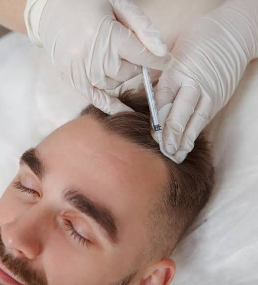 PRP Hair Loss Treatment at London Hair Transplant Clinic
