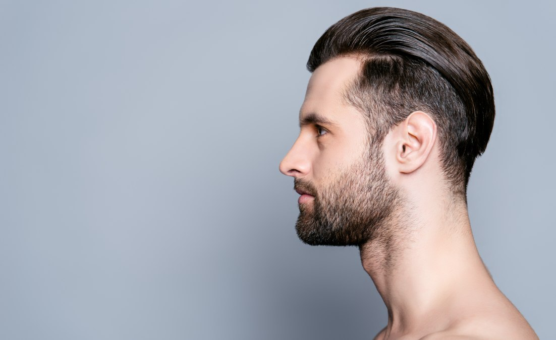 Beard and facial hair transplant at London Hair Transplant Clinic