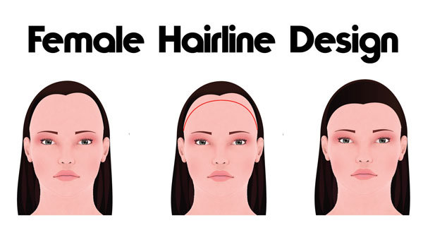 Female Hairline Design
